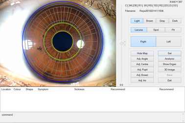 Анализатор блока развертки радужки глаза портативного CE Handheld для здоровья обнаруживает