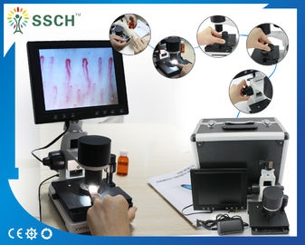 Одобренная CE микроциркуляция капилляра микроскопа экрана LCD медицинская