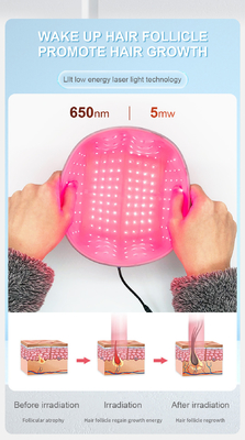 рост волос шлема лазера обработки выпадения волос диода красного света 200 650nm Lllt