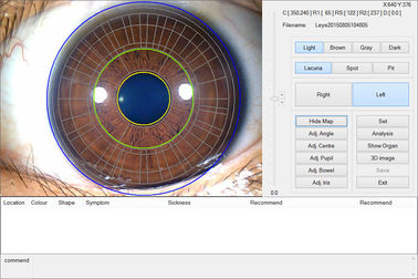 утверждение машины испытания КЭ/ДХЛ глаза камеры 12.0МП цифров Ирископе Иридологы