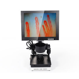 Портативная машинка машина теста микроциркуляции Капиллароскопы створки ногтя дисплея СИД 10 дюймов