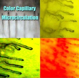 Микроскопия капилляра Nailfold больницы/функция микроскопа микроциркуляции Multi для медицинской