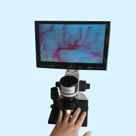 Дом больницы машины испытания микроциркуляции цвета дисплея LCD клинический