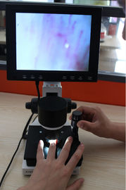 Высокая микроциркуляция LCD определения проверяя аппаратуру обнаружения Nailfold микроскопа видео-