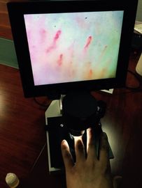 Одобренный CE микроскоп микроциркуляции цвета экрана OEM LCD для проверять ногтя