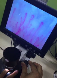 Микроскоп микроциркуляции следующего поколени, микроскоп кровеносного сосуда для здравоохранения