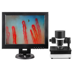 Выход увеличения ДК12В 2А микроскопа 600С микроциркуляции капилляра крови